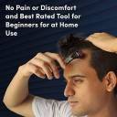 Derma Roller For Hair And Beard Regrowth, 540 Micro 0.5mm Titanium Alloy Needles Reduces Hair Fall & Stimulates Hair Follicles, For Men & Women